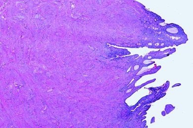 Mikropräparat - Uterus, gravid, quer