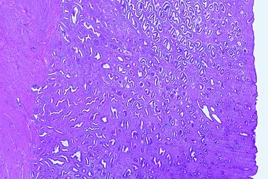 Mikropräparat - Uterus, Desquamationsphase (Menstruation), quer