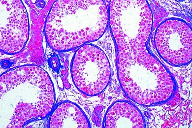 Mikropräparat - Hoden vom Mann, quer