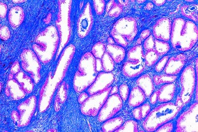 Mikropräparat - Prostata, jugendlich, quer
