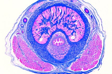 Mikropräparat - Penis, jugendlich, quer