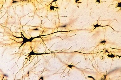 Mikropräparat - Großhirnrinde, quer, Silberimprägnation