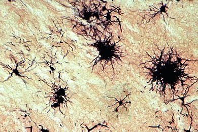 Mikropräparat - Großhirnrinde, quer, Neurogliafärbung nach Held