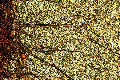 Mikropräparat - Rückenmark, quer. Silberimprägnation