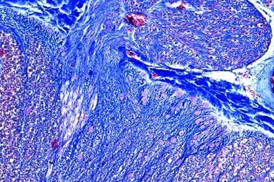 Mikropräparat - Dorsales Ganglion, quer, Übersichtsfärbung