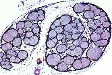 Mikropräparat - Peripherer Nerv, quer