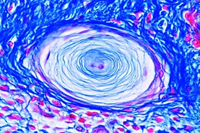 Mikropräparat - Vater-Pacinische Tastkörper in der Fingerbeere Schnitt