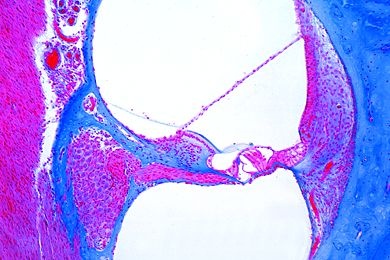 Mikropräparat - Innenohr des menschlichen Embryos, quer