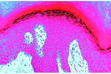 Mikropräparat - Haut von der Fußsohle, quer (vertikal)