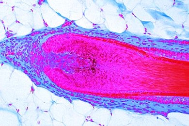 Mikropräparat - Kopfhaut mit Haaren, Haarwurzeln längs