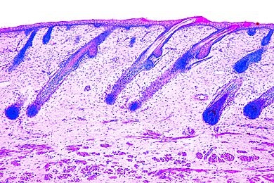 Mikropräparat - Kopfhaut vom Foetus, Haarwurzeln längs
