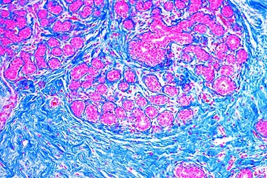 Mikropräparat - Milchdrüse, laktierend, quer