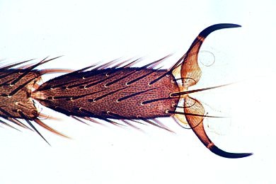 Mikropräparat - Musca domestica, Stubenfliege, Bein mit Haftballen Mikropräparat - Musca domestica, Stubenfliege, Bein mit Haftballen