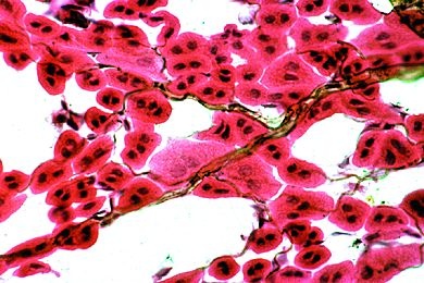Mikropräparat - Tracheen im Insektendarm, Imprägnation mit Kupfersulfid zur Darstellung der feinsten Verzweigungen *