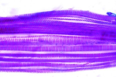 Mikropräparat - Quergestreifte Muskeln im Schnitt durch Insektenthorax