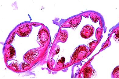 Mikropräparat - Chylusanhänge und Malpighische Gefäße, quer. Feinbau
