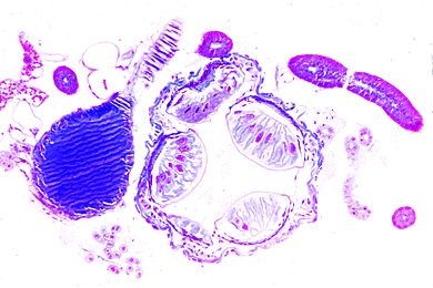 Mikropräparat - Periplaneta, Rectaldarm mit Ampullen, quer