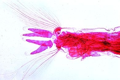 Mikropräparat - Anopheles, Larve total