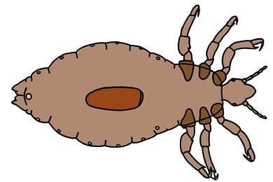 Mikropräparat - Pediculus humanus capitis, Kopflaus, total