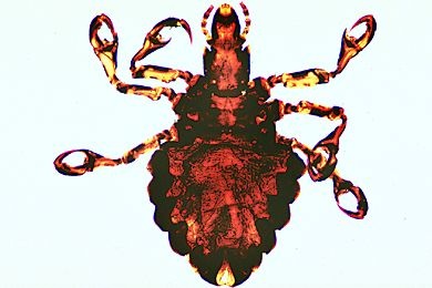 Mikropräparat - Haematopinus suis, Schweinelaus, total