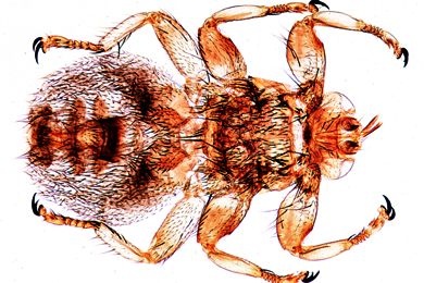 Mikropräparat - Lipoptena, Lausfliege, total