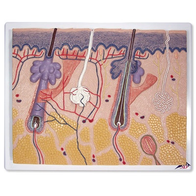 Hautschnitt, 70-fache Größe