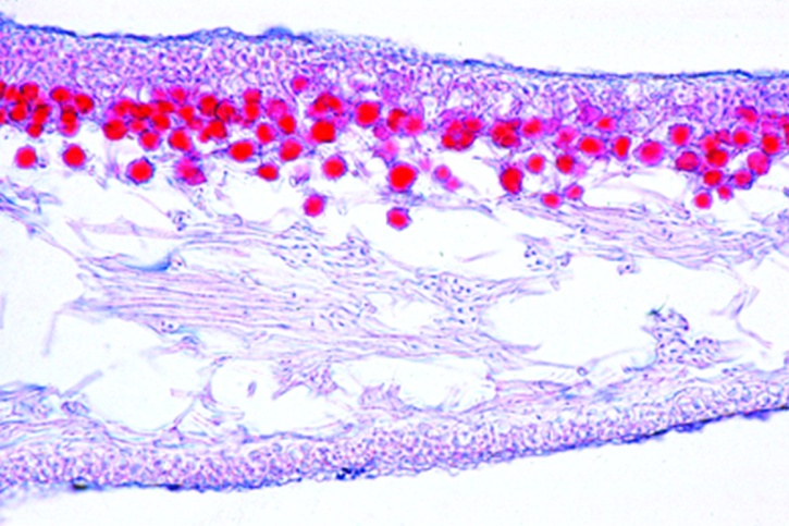 Mikropräparat - Physcia, Laubflechte, Thallus mit symbiotischen Algen, quer