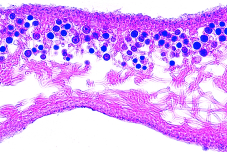 Mikropräparat - Xanthoria, Schüsselflechte, Thallus, quer, Mycel mit symbiontischen Algen