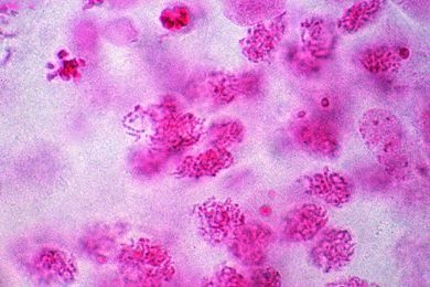 Mikropräparat - Meiosestadien, Ausstrich vom Hodengewebe (Feulgen-Reaktion)