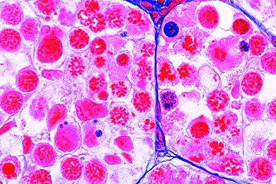 Mikropräparat - Meiosestadien im Schnitt durch den Salamanderhoden *