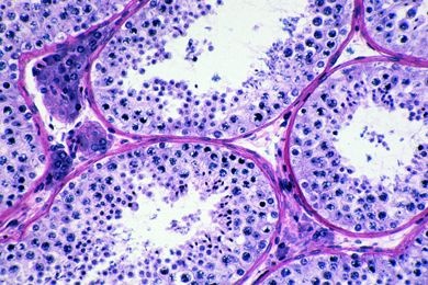 Mikropräparat - Meiosestadien (Reifungsteilungen) im Hoden der Maus