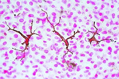 Mikropräparat - Pigmentzellen in der Haut