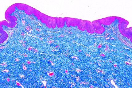 Mikropräparat - Plattenepithel, Vagina vom Kaninchen, quer