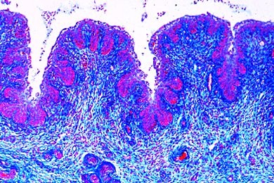 Mikropräparat - Mehrschichtiges, nicht verhorntes Plattenepithel im Schnitt durch die Vagina vom Schwein