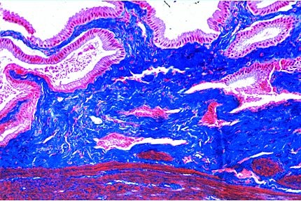 Mikropräparat - Zylinderepithel, Gallenblase vom Mensch, quer