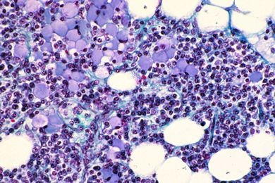 Mikropräparat - Mastzellen im Omentum der Ratte. Färbung mit Toluidinblau-Paracarmin