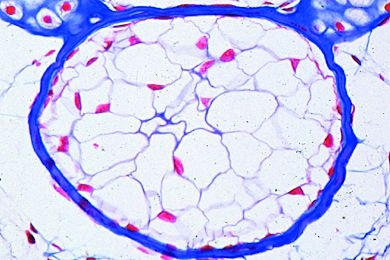Mikropräparat - Vesikuloses Gewebe, zelliges Bindegewebe ohne Zwischensubstanz, ...