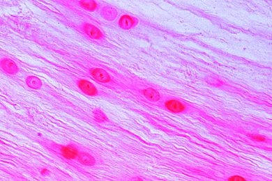 Mikropräparat - Faserknorpel (Bindegewebsknorpel) vom Rind, quer