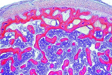 Mikropräparat - Knochen vom Rind, spongiöse Substanz, quer