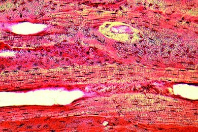 Mikropräparat - Knochen vom Rind, kompakte Substanz, längs