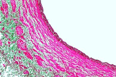 Mikropräparat - Vene der Katze, quer