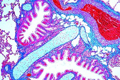 Mikropräparat - Bronchien der Katze, quer