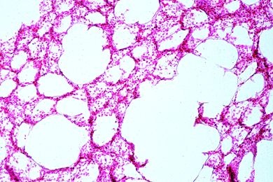 Mikropräparat - Lunge der Katze, quer. Färbung der elastischen Fasern