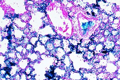 Mikropräparat - Lunge der Katze, quer. Blutgefäßen injiziert