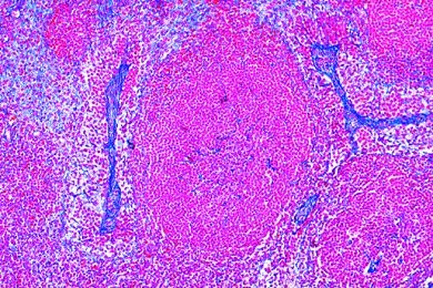 Mikropräparat - Lymphknoten vom Schwein, quer.