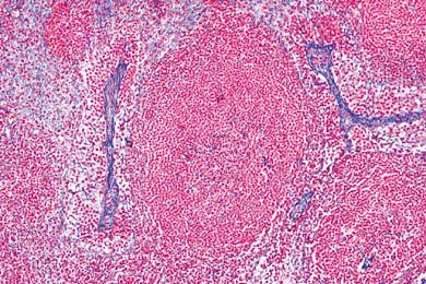 Mikropräparat - Lymphknoten der Katze, quer