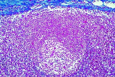 Mikropräparat - Milz, Meerschwein, quer