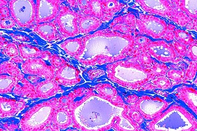 Mikropräparat - Schilddrüse (Gl. thyreoidea) vom Rind, quer. Kolloid