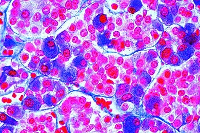 Mikropräparat - Hypophyse vom Schwein, quer. Feinstruktur des Vorderlappens. Darstellung der verschiedenen Zelltypen