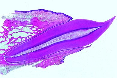 Mikropräparat - Zahn vom Mensch, sagittal längs